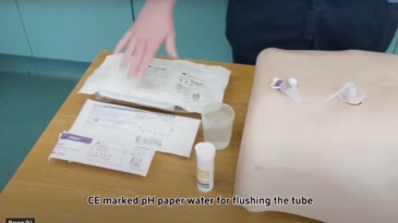 Percutaneous Endoscopic Gastrostomy (PEG) Tube /Kit