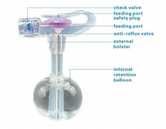 Mini Button Gastrostomy Tube