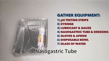 Nasogastric Feeding Tube