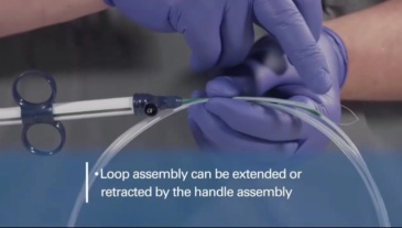 Disposable Polypectomy Snare