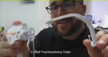 Tracheostomy Tube