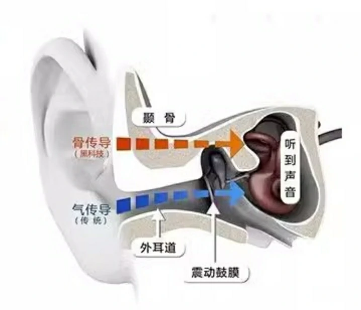 Are Bone Conduction Headphones Safe