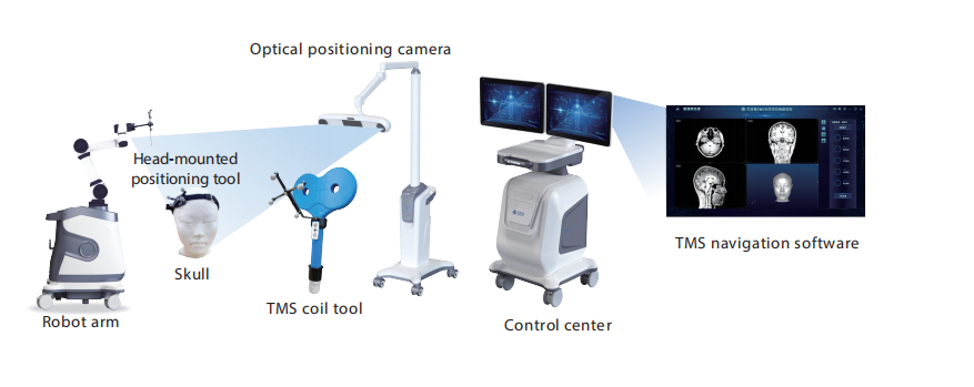 TMS (Transcranial Magnetic Stimulation) Navigation System | TMS Therapy | Brain Stimulation
