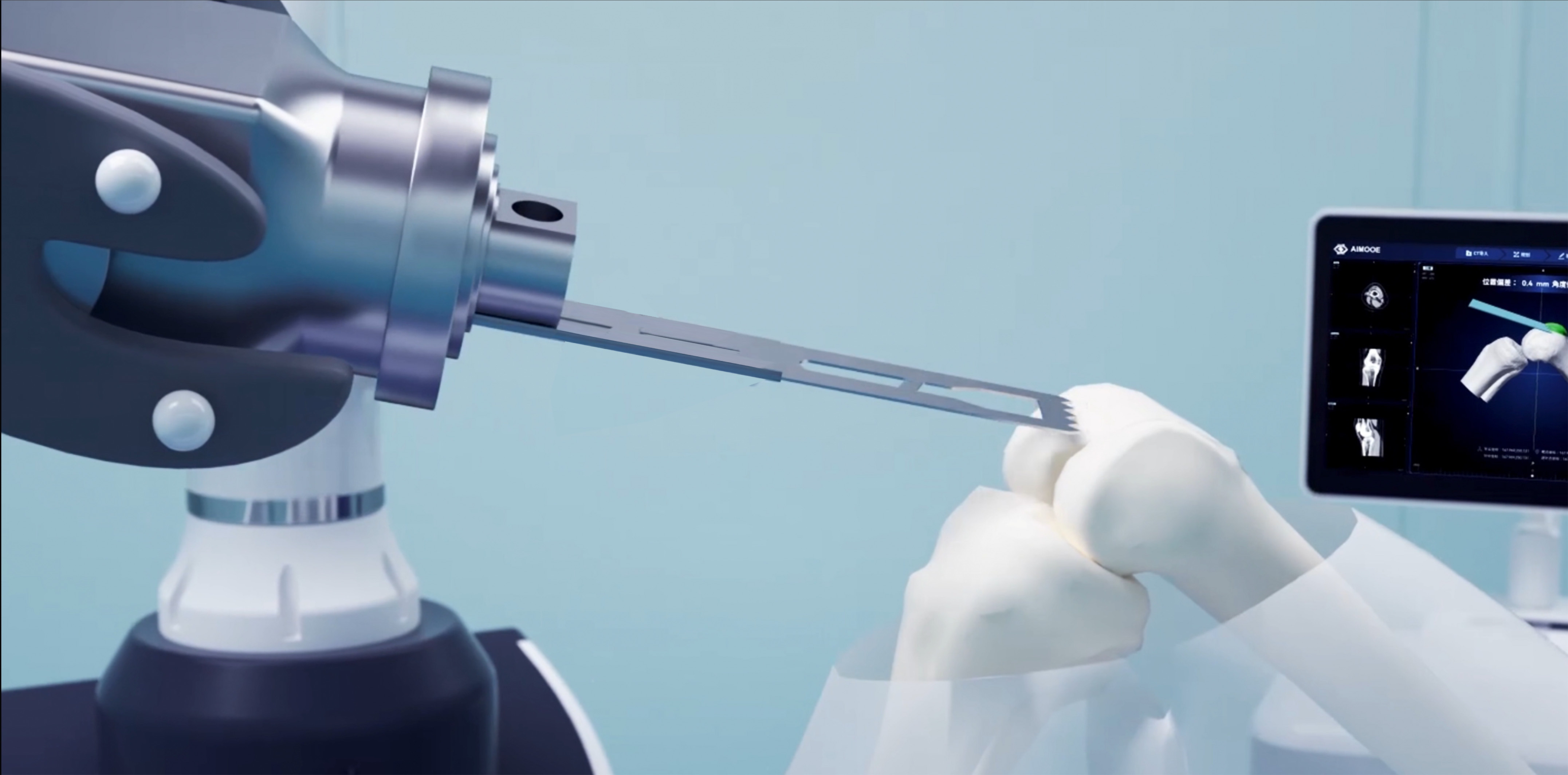 Robot-assisted Knee Replacement Surgery Navigation System Solution