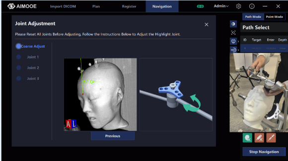 Neurosurgery Navigation System Solution - Redifined Cranial Navigation - Tumor Biopsy - Minimally Invasive Neurosurgery