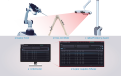 Robot-assisted Knee Replacement Surgery Navigation System Solution
