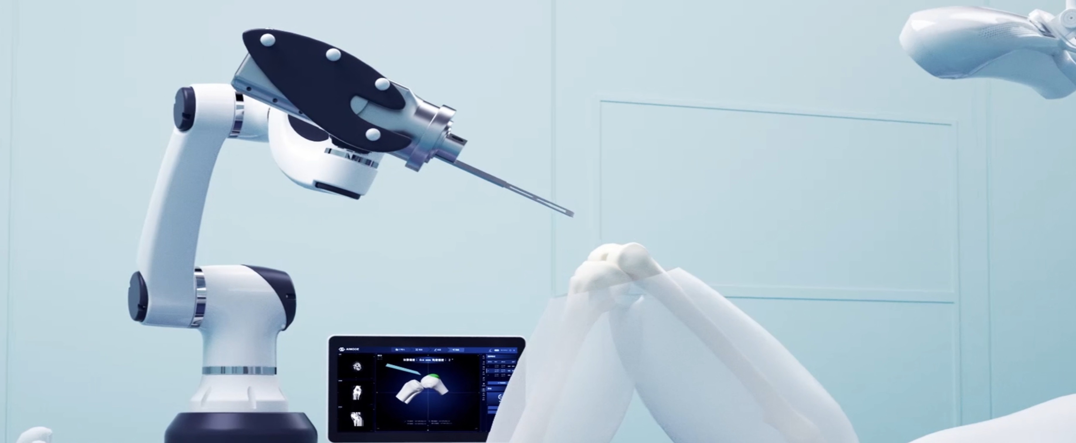 Robot-assisted Knee Replacement Surgery Navigation System Solution