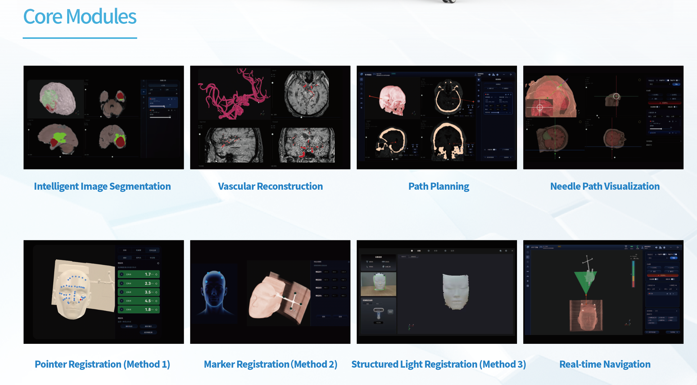 Neurosurgery Navigation System Solution - Redifined Cranial Navigation - Tumor Biopsy - Minimally Invasive Neurosurgery