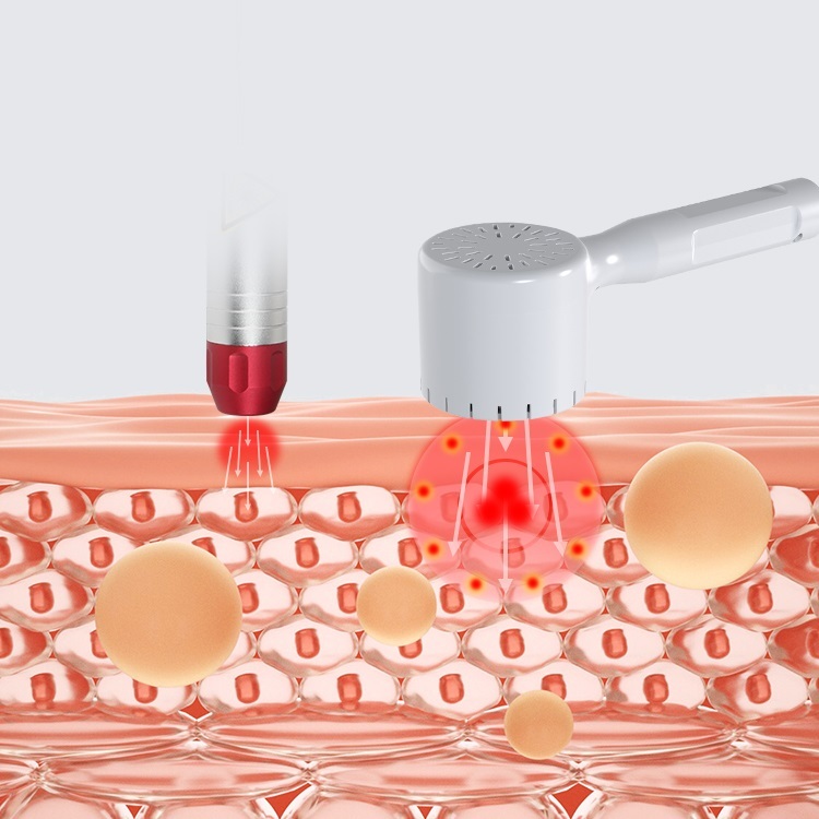Best Laser Pain Relief Therapy Device Laser Acupuncture Physiotherapy Medical Laser Equipment