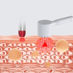 Best Laser Pain Relief Therapy Device Laser Acupuncture Physiotherapy Medical Laser Equipment