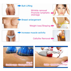 Best Popular Butt Enhancement Suction Cupping Vacuum Therapy Buttocks Lifting Machine