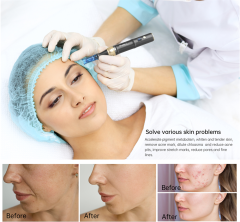 Dr.pen A8S Wireless Microneedle Therapy System Derma Pen