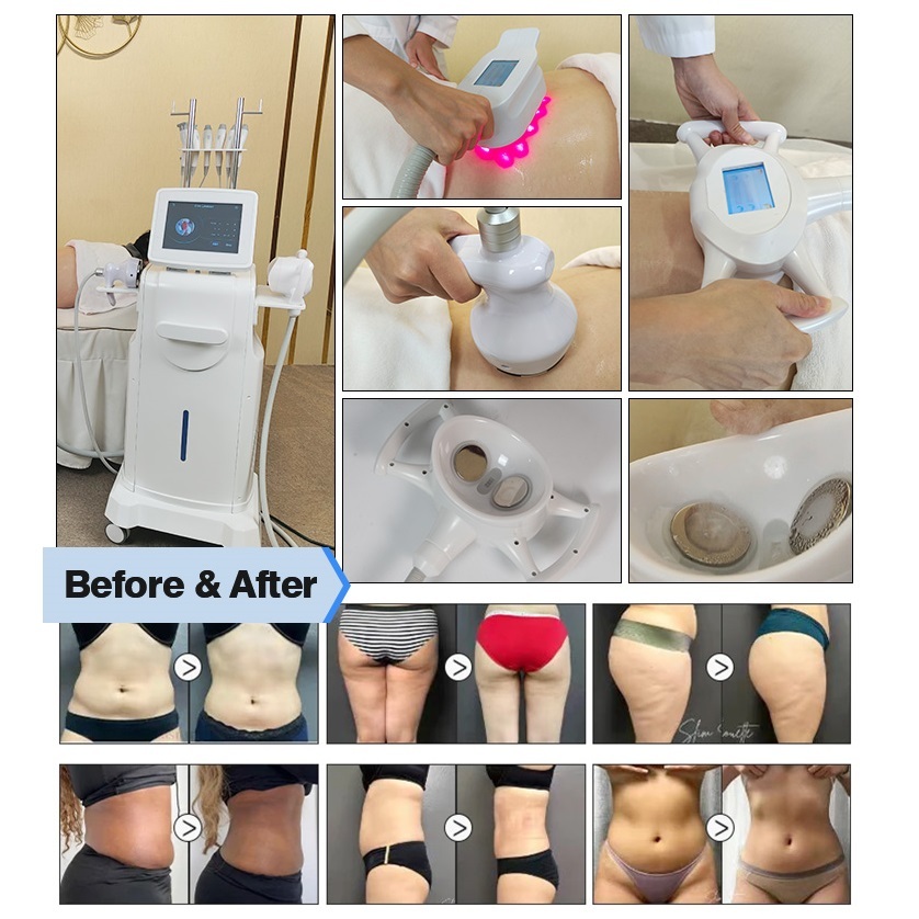 Newest Multifunctional 9 in 1 Body Slimming Machine With Vacuum Cavitation And RF