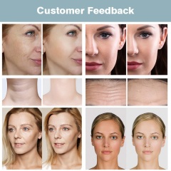 Beauty Salon 6 in 1 Multipole RF Skin Reiuvenation Equipment