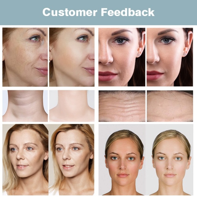 Beauty Salon 6 in 1 Multipole RF Skin Reiuvenation Equipment