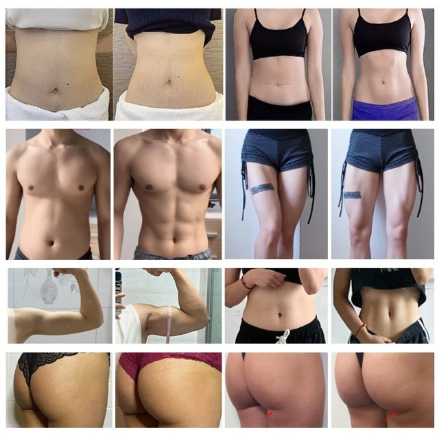 Easy to operate High power emslim machine electromagnetic muscle stimulation weight loss machine ems