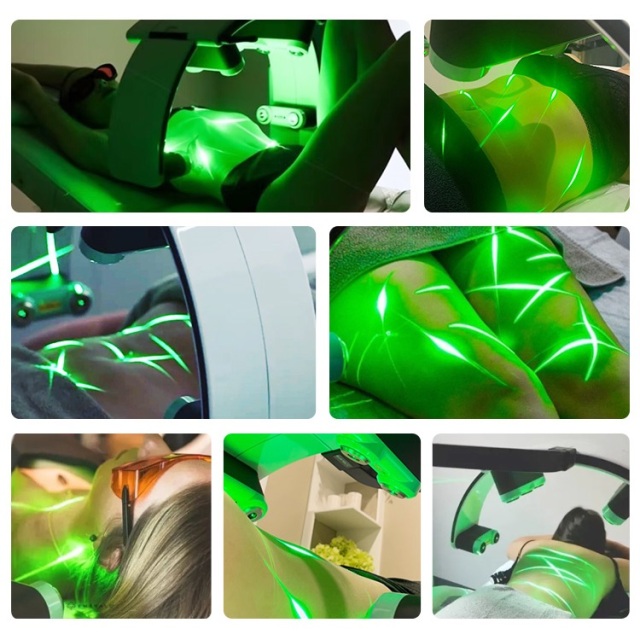 CLASS II Green Laser 532Nm LLLT Low Level Laser Therapy Fat reduction Machine