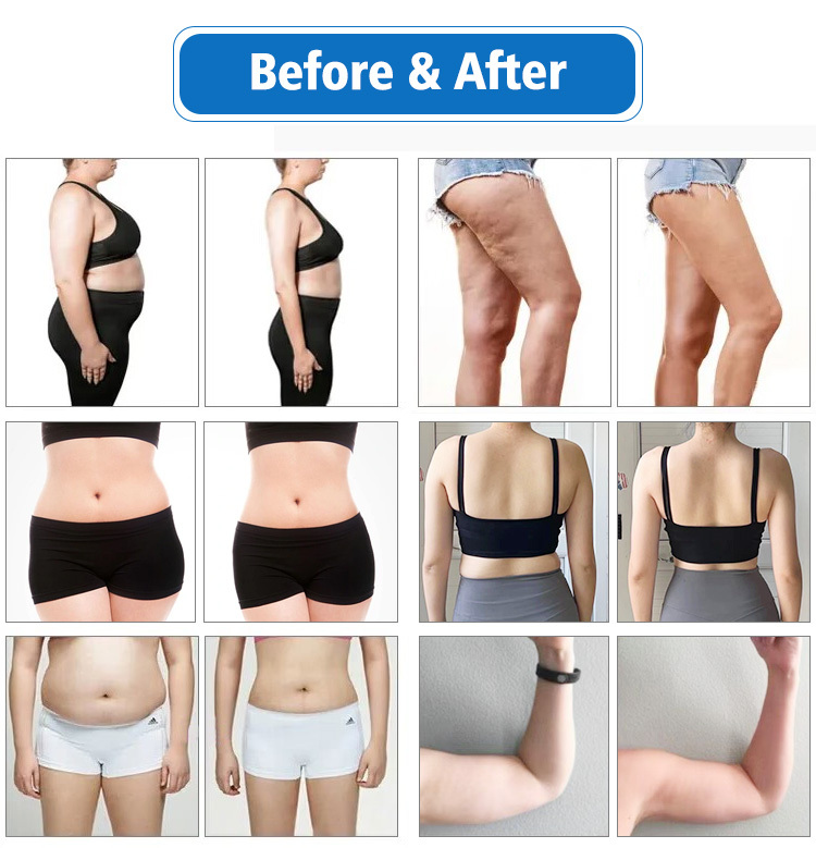 High quality 10D Maxlipo Laser 532nm Green Light Laser Fat Reduction Machine