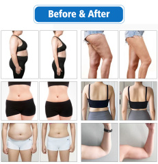 High quality 10D Maxlipo Laser 532nm Green Light Laser Fat Reduction Machine
