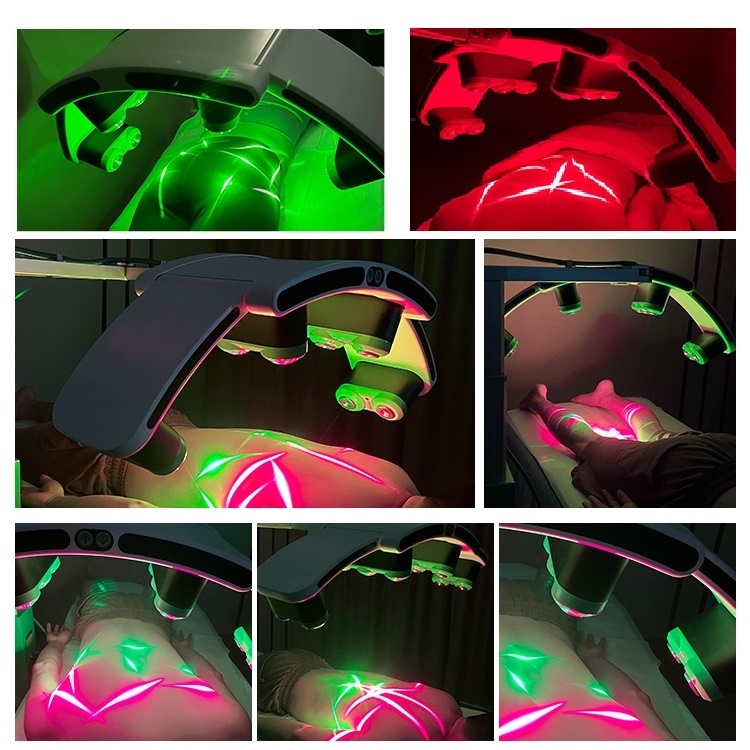 Newest 532nm Green Light Laser 10D Mate Laser Fat Reduction Equipment