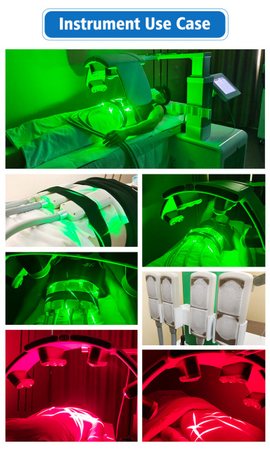 High quality 10D Maxlipo Laser 532nm Green Light Laser Fat Reduction Machine