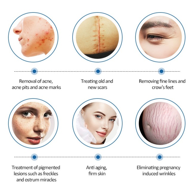 2024 New Arrived Co2 Fractional Laser Beauty Equipments For Scar removal