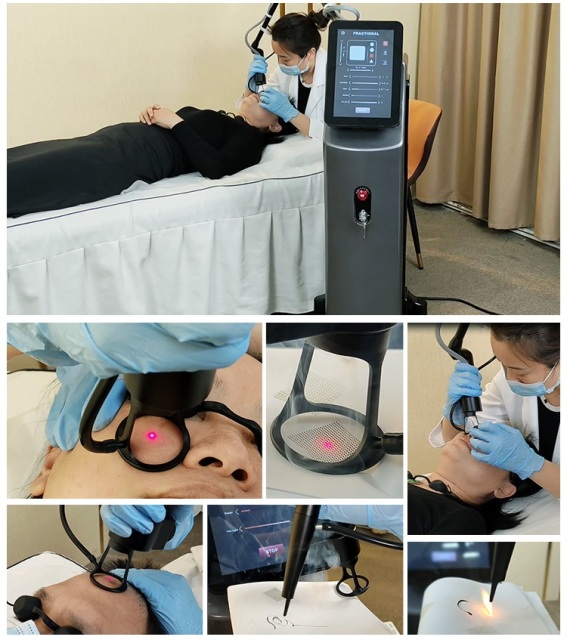 2024 New Arrived Co2 Fractional Laser Beauty Equipments For Scar removal