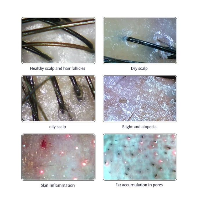 Multifunctional scalp analyzer hair care device