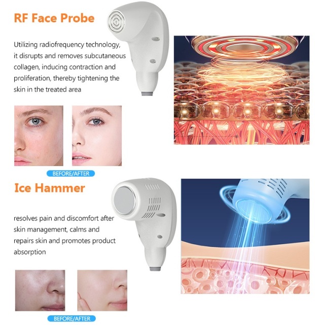 Face Care Skin Tightening Remove wrinkles Anti aging EMS RF Beauty Device