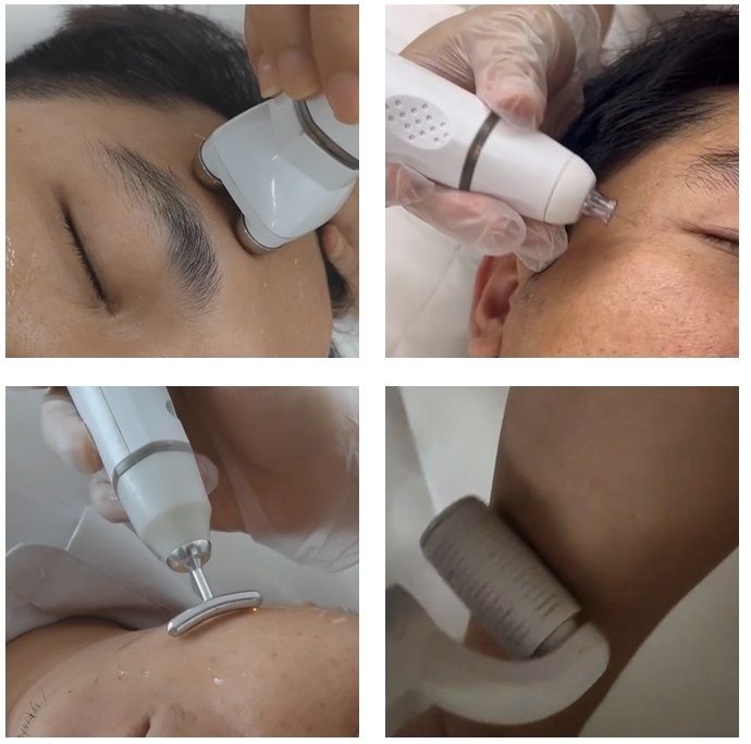 Plasma Acne Treatment Facial Skin Rejuvenation Deep Pore Cleaning Rf Ems Plasma Pen