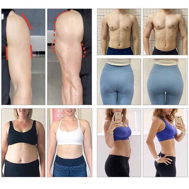 2 in 1 Body Slimming Machine EMS Sculpt Slimming Machine 532nm Diode 10D Laser Slimming Machine