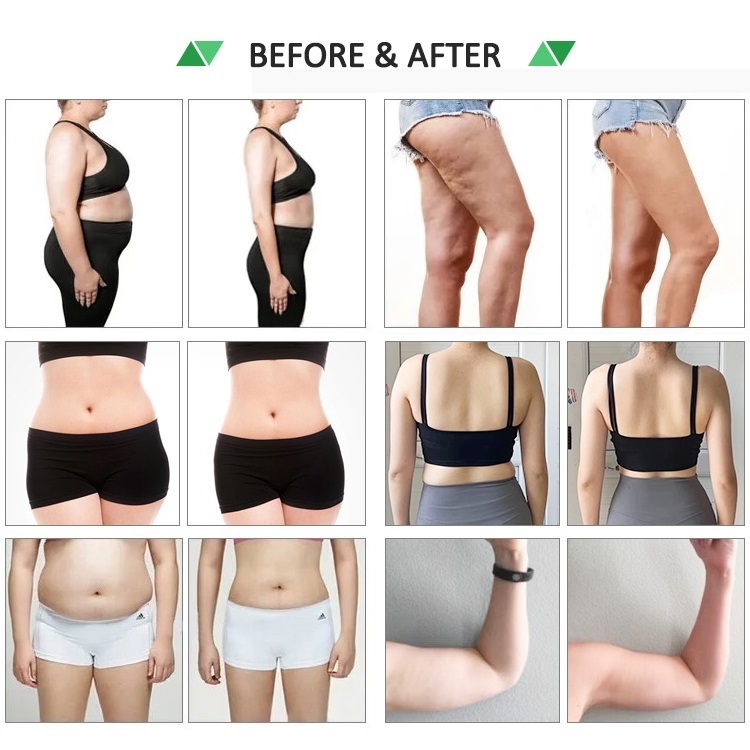 10D LLLT Laser Beauty Equipment 532Nm Cold Laser Cellulite Reduction Body Slimming Laser Beauty Machine