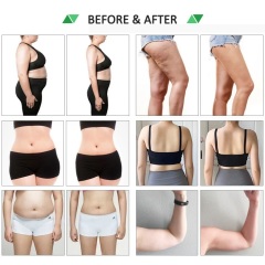 10D LLLT Laser Beauty Equipment 532Nm Cold Laser Cellulite Reduction Body Slimming Laser Beauty Machine