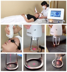 Professional 1927nm Thulium Laser Scare Remove Skin Tightening Portable Fractional Laser