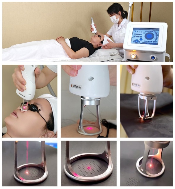 Professional 1927nm Thulium Laser Scare Remove Skin Tightening Portable Fractional Laser