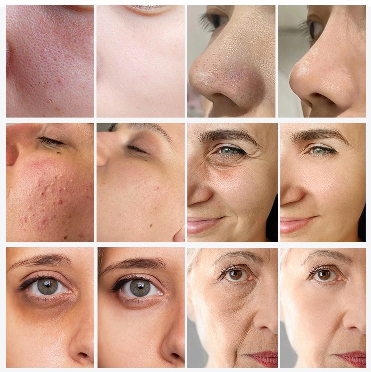 9 in 1 Small Bubble Oxygen Facial Beauty Device