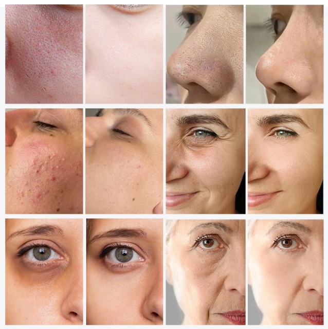 9 in 1 Small Bubble Oxygen Facial Beauty Device