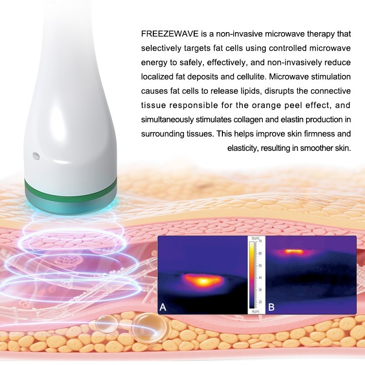 2450mhz Freeze Wave Cryo Therapy Microwave Body Slimming Anti Wrinkle Beauty Treatments