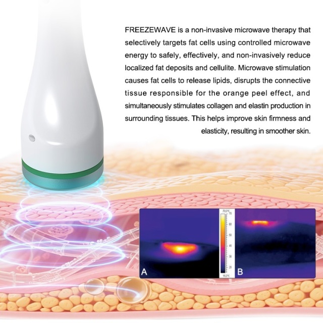 2450mhz Freeze Wave Cryo Therapy Microwave Body Slimming Anti Wrinkle Beauty Treatments