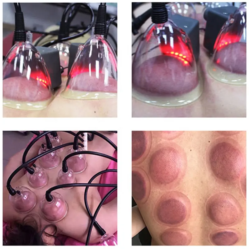 Professional Vacuum Guasha Machine Vacuum Cupping Vacuum Butt Lifting Machine