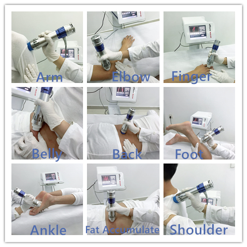 High quality Extracorporeal Shock wave Therapy Equipment For Pain/Erectile Dysfunction Treatment And Weight loss