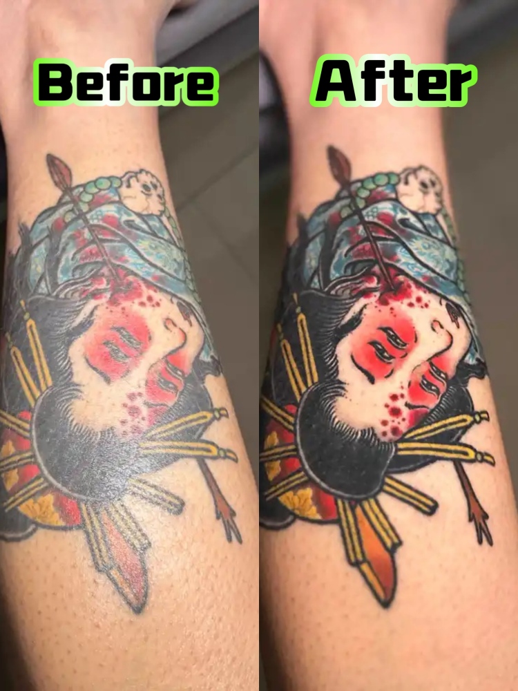 MK  Tattoo auxiliary artifact photography fill light to increase color saturation and remove reflections