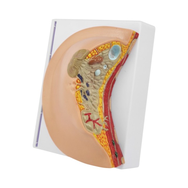Breast Anatomical Model with White Stand