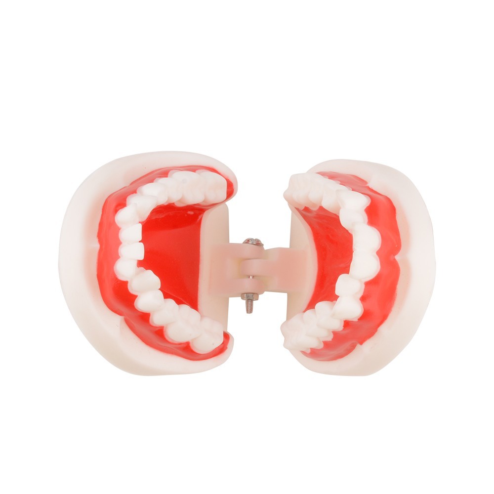Dental Malocclusion Teeth Model - Distal, Mesial Occlusion Demonstration