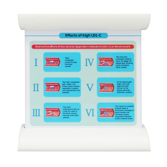 Dynamic Blood Vessel, Normal & Atherosclerosis Model for Education