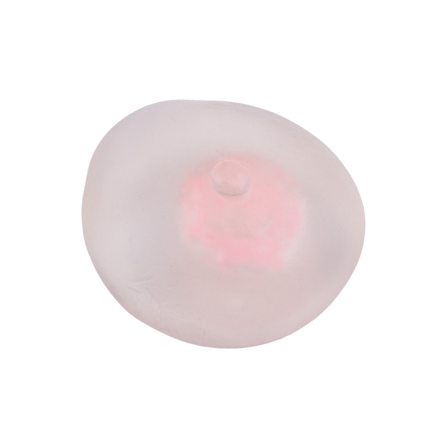 Female Fibroadenoma Breast Model for Education