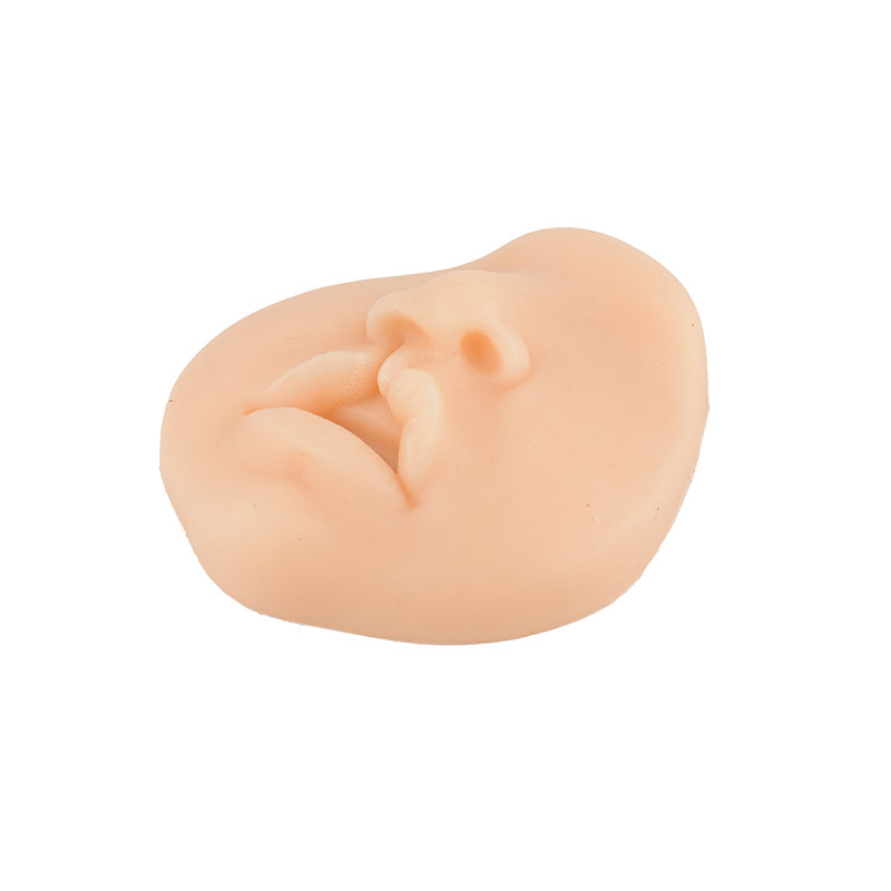 Pediatric Bilateral Incomplete Cleft Lip for Repair Suture Practice Model