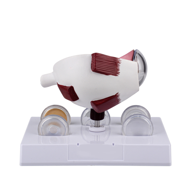Oversized Human Cataract Eye Anatomy Model for Patient Education