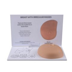 Breast Self Exam(BSE) Model with Irregular Masses