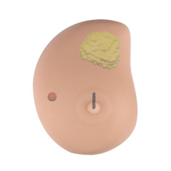 Breast Self Exam(BSE) Model with Irregular Masses